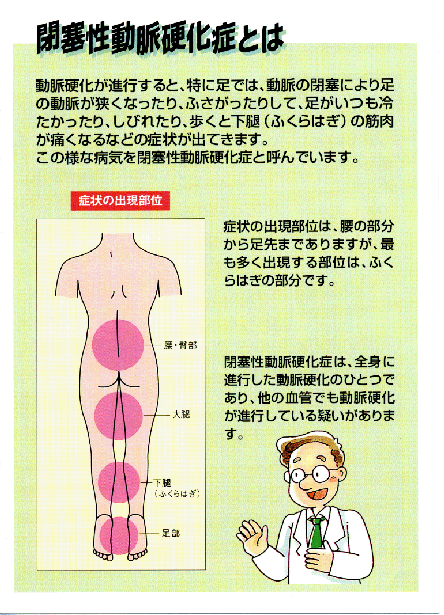 閉塞性動脈硬化症とは