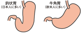 胃の形