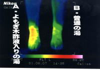 よもぎ木酢液の効果