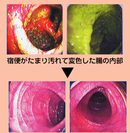 痩せる誰でも お茶で痩せるって 100 成功 近赤外光線 糖尿病治療 おなかがへこむ