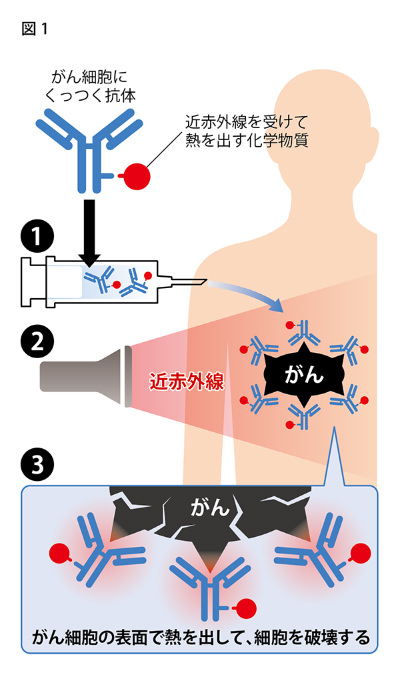 図１：近赤外線を使った新しいがん治療法のイメージ