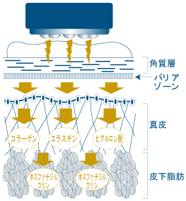 エレポ原理図