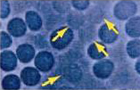 溶血赤血球(ゴースト細胞)