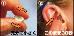 スナップチップの装着方法