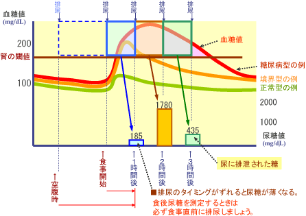 尿糖値と血糖値の関係