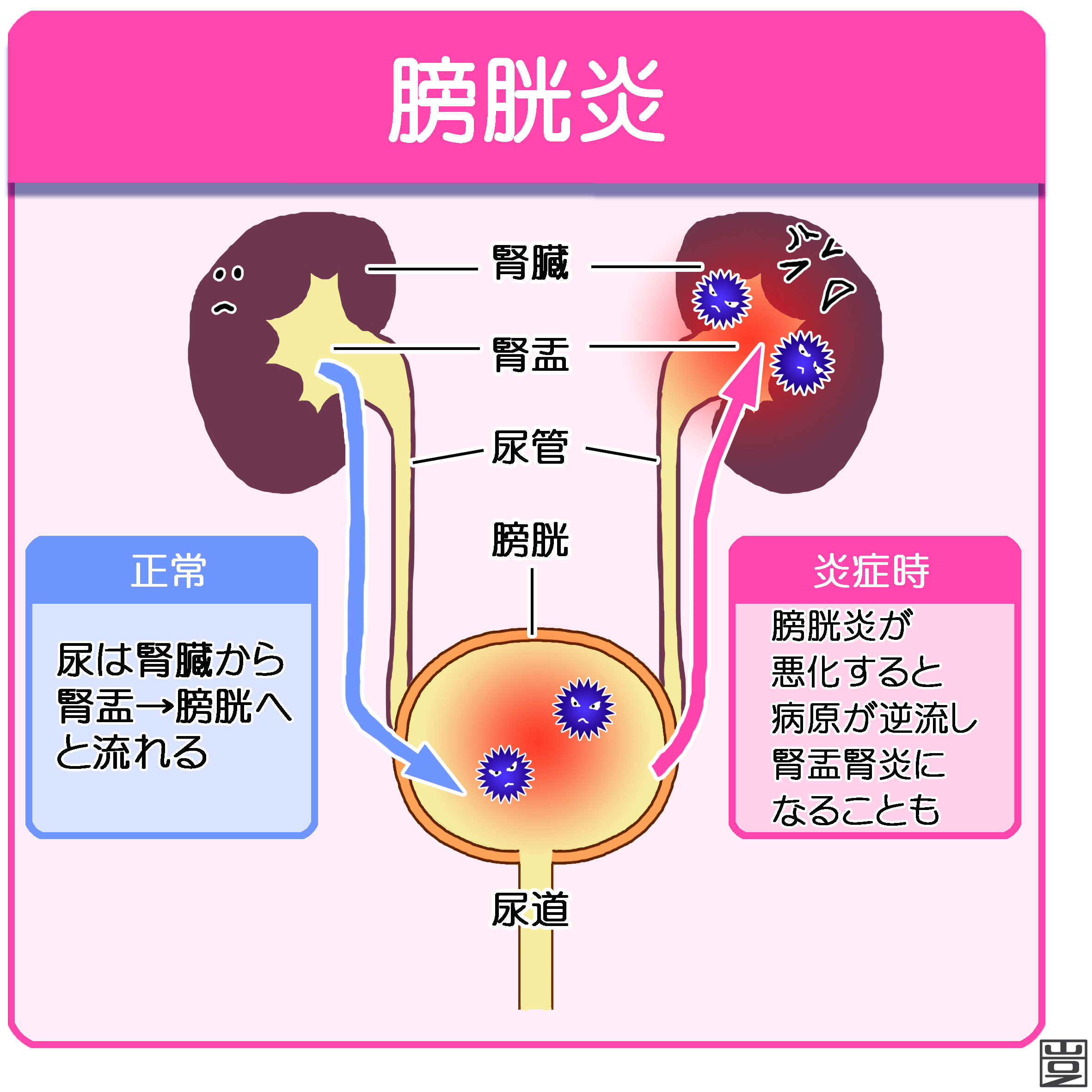 頻尿 治療 膀胱炎 夜尿 治る 貼るシール 夜にトイレ何回もいく 薬も漢方薬も 効果がない テレビ広告 夜のトイレ