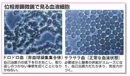 位相差顕微鏡で見る血液細胞