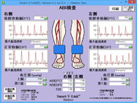 ABI検査