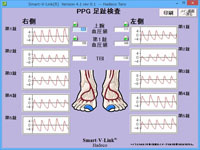 PPG足趾検査