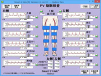 PV動脈検査