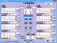 下肢動脈検査
