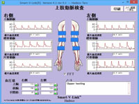上肢動脈検査