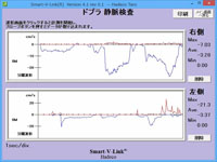 ドプラ静脈検査
