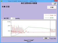 血圧波形表示画面